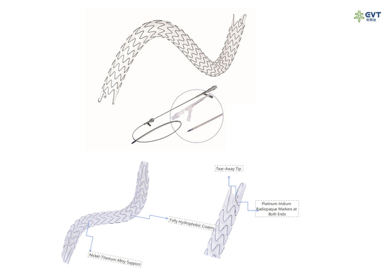Maximized Lumen URS Stent With Hydrophobic Nitinol Technology Anti Embedding Coating