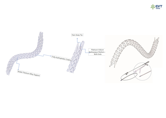 Accurate Placement Urs Dj Stent Radio Opaque Marker Nitinol Frame