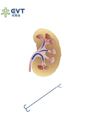 High Value Ureteral Access Sheath Endourology Practices Access Sheath Urology