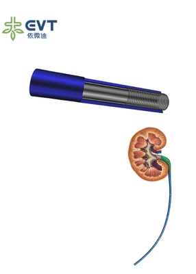 Smart Urethral Access Sheath Bluetooth Alerts 35cm Length With Pressure Monitoring