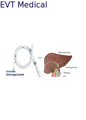 Standard Pigtail Loop Biliary Drainage Catheter External Biliary Drainage with Platinum Marker One Click Lock