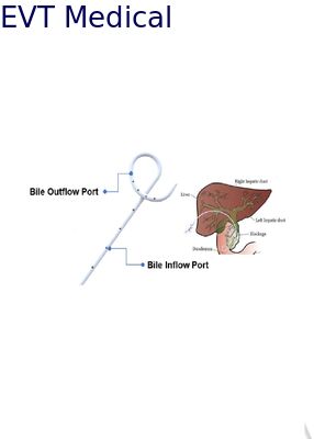 Long Pigtail Loop Biliary Drainage Tube for Internal‑External Bile Drainage Medical Grade PU High Flow Design