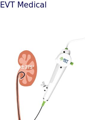 Ultra-Slim Disposable Flexible Ureteroscope for Advanced Stone Management