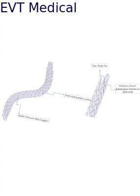 Nitinol Ureteric Stents Double Ureter Surgery With Hydrophobic Coating Enhanced Visibility
