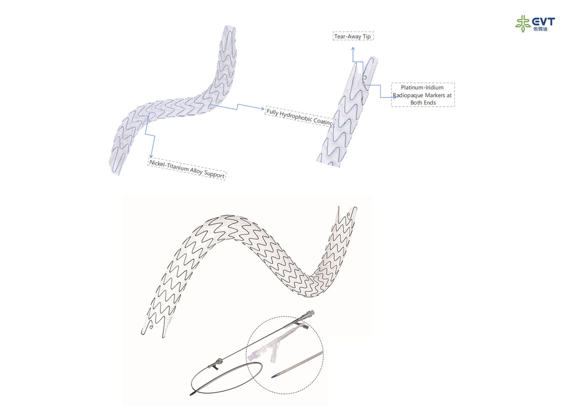 Large Lumen Urethral Stent Hydrophobic Nitinol Design For Precision Placement