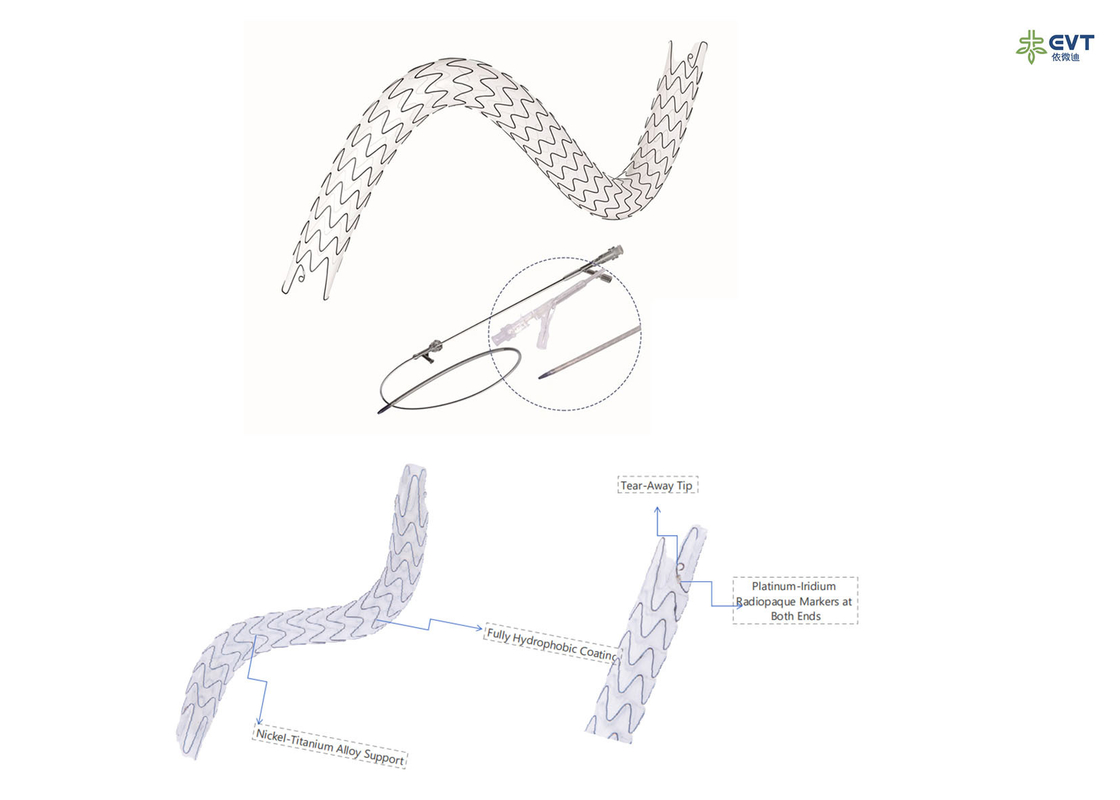 Maximized Lumen URS Stent With Hydrophobic Nitinol Technology Anti Embedding Coating
