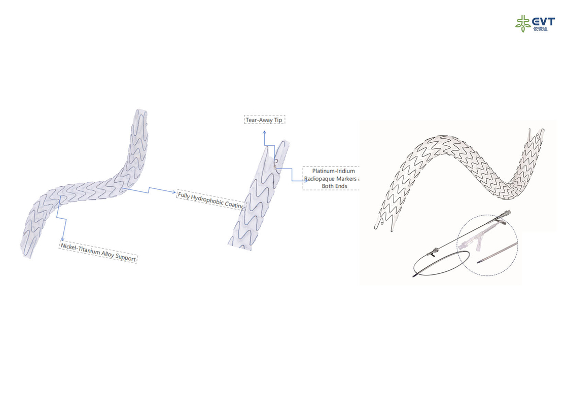 Accurate Placement Urs Dj Stent Radio Opaque Marker Nitinol Frame