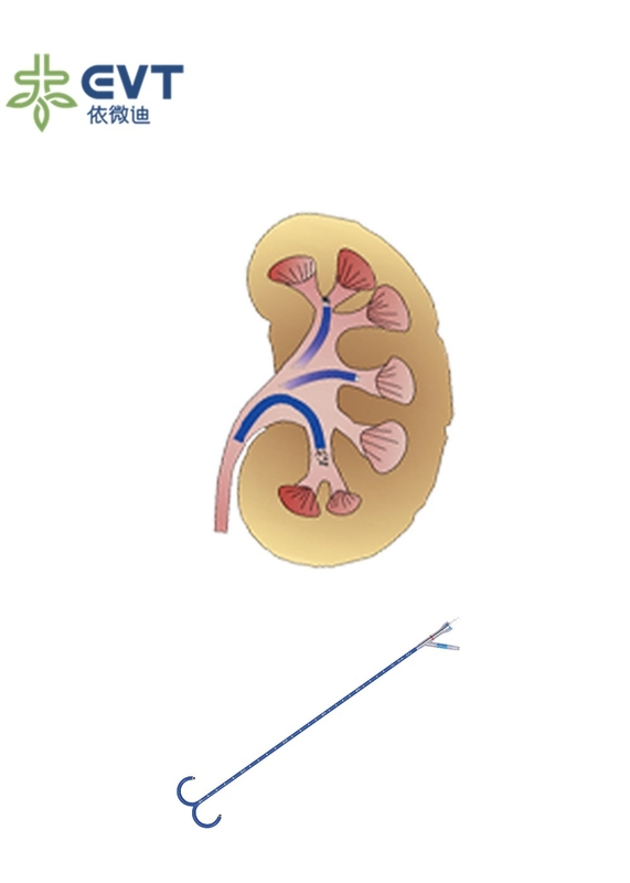 High Value Ureteral Access Sheath Endourology Practices Access Sheath Urology
