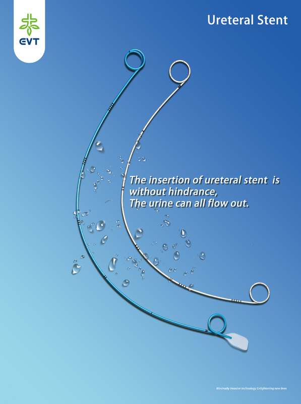 Larger Diameter Ureteral Stent Placement Hydrophilic Allium Stent Surgical Supplies