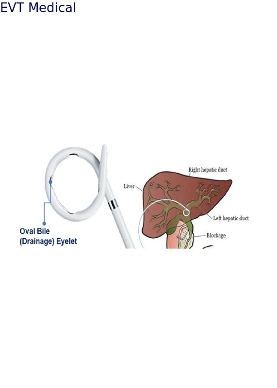 Standard Pigtail Loop Biliary Drainage Catheter External Biliary Drainage with Platinum Marker One Click Lock