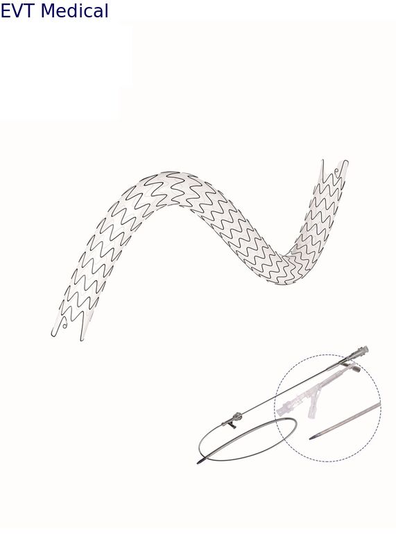 Nitinol Ureteral Stent Set High Accuracy With Low Friction Coating And Big Lumen