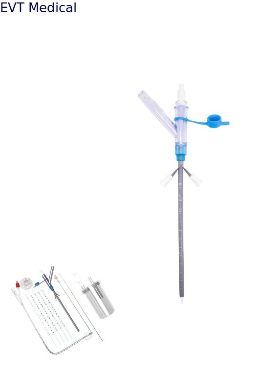 Negative Pressure Pigtail Nephrostomy Catheter With Integrated Stone Management