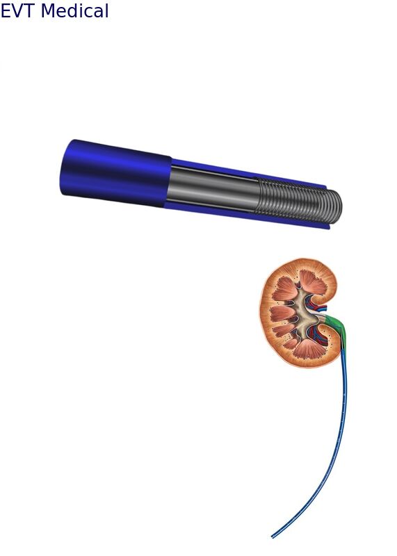 Smart Urethral Access Sheath Bluetooth Alerts 35cm Length With Pressure Monitoring