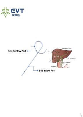 Catetere per Drenaggio Biliare con Ansa a Coda di Maiale Lunga per Drenaggio Biliare Interno-Esterno in PU di Grado Medico con Design ad Alto Flusso
