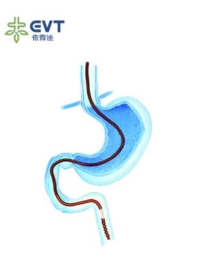 Bộ ống thông ruột hỗ trợ nội soi với Công nghệ Vòng khâu